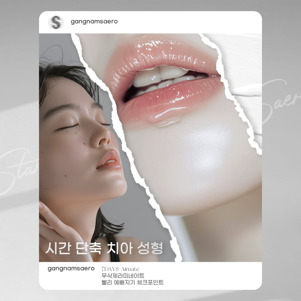 무삭제라미네이트 로 완성하는 가장 빠른 치아성형 (7DAYS치아성형) 관련 이미지 1