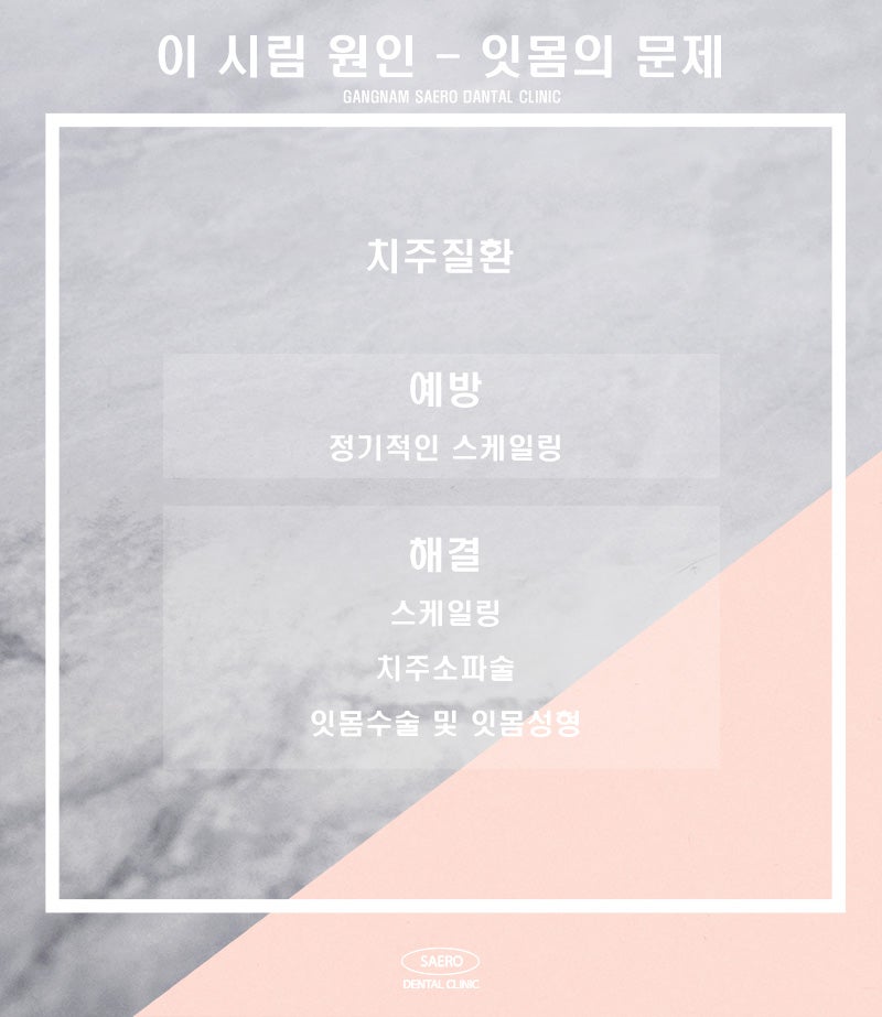 갑자기 이가 시릴 때 정확한 원인과 올바른 해결 방법 (이시림이유) 관련 이미지 4