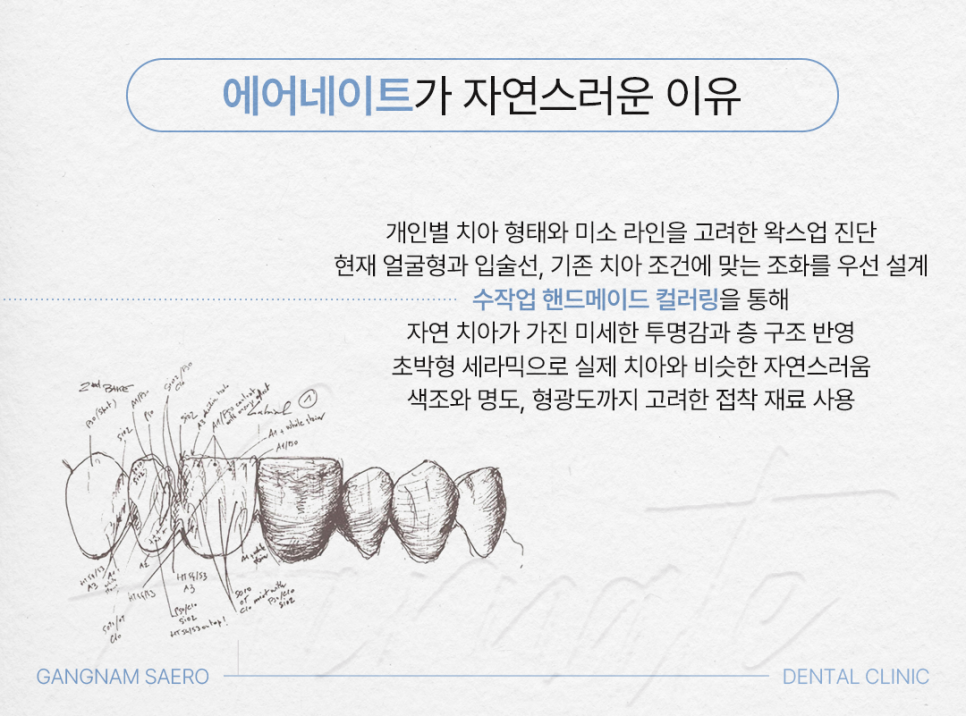 라미네이트로 빠르게 예뻐지고 싶다면 (무삭제라미네이트) 관련 이미지 6