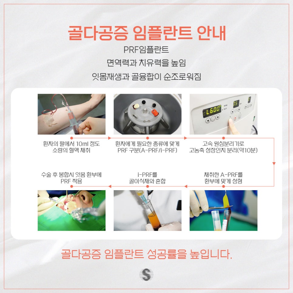 골다공증 증상 및 원인 그리고 임플란트 (골다공증임플란트 PRF임플란트) 관련 이미지 7
