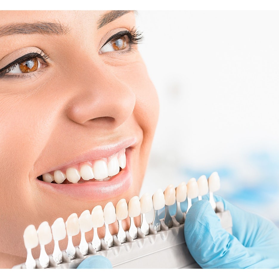 라미네이트주의사항, 경우에 따라 치아 치료 전, 후 알아보고 가자. 관련 이미지 2