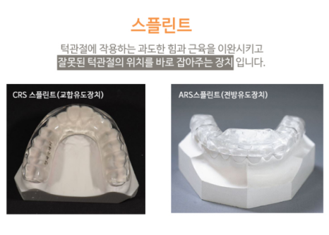 강남턱관절치과, 비수술 턱통증치료 궁금하다면 필독 관련 이미지 11