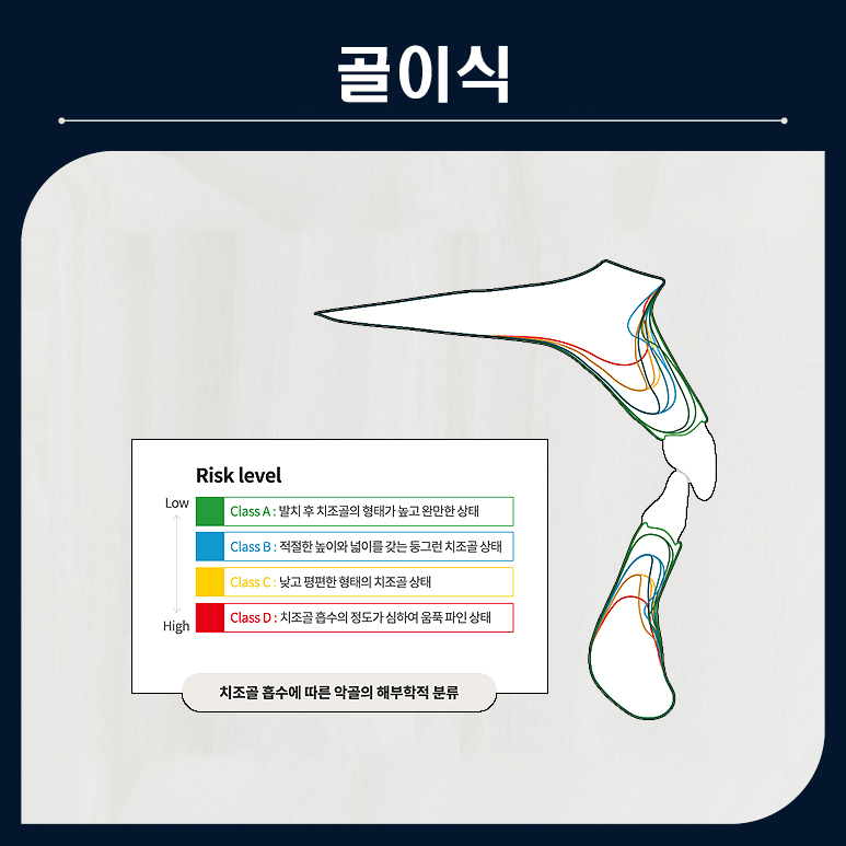 임플란트에 공경심을 담아봅니다 (건강보험임플란트) 관련 이미지 4