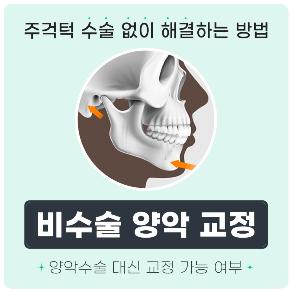 반대교합 비수술 교정 (주걱턱양악교정) 관련 이미지 1