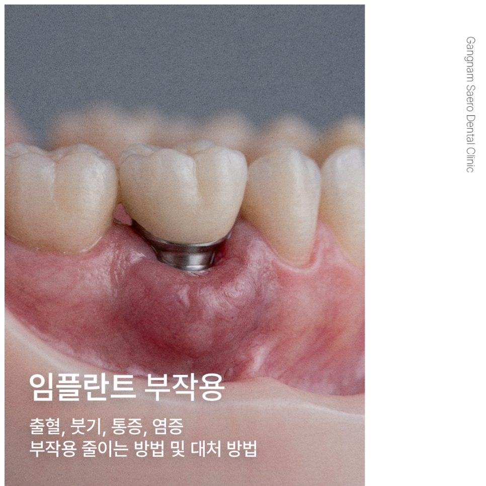 Implant Surgery Side Effects (Bleeding, Swelling, Pain, and Inflammation): Prevention and Management image 2