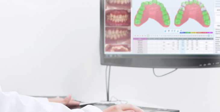 투명교정회사 투명교정종류 투명교정장치 (3) 매직얼라인 관련 이미지 5