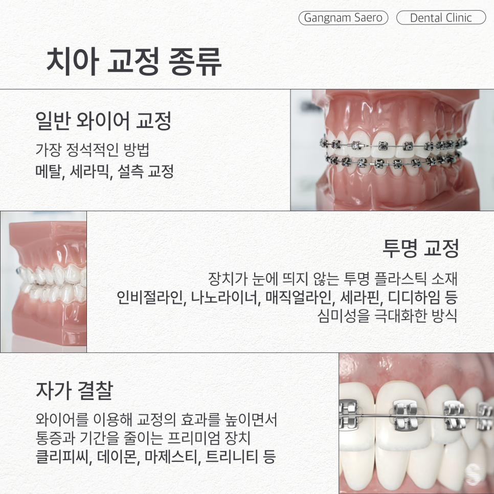통증과 기간을 줄여주는 프리미엄 교정장치 (자가결찰교정) 관련 이미지 2