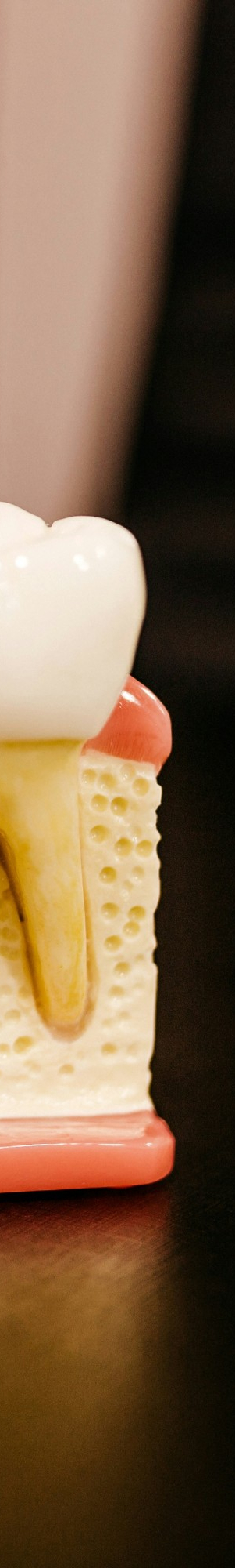 임플란트 식립이 불가능할 수도 있는 건강 상태 알아보기. 관련 이미지 11