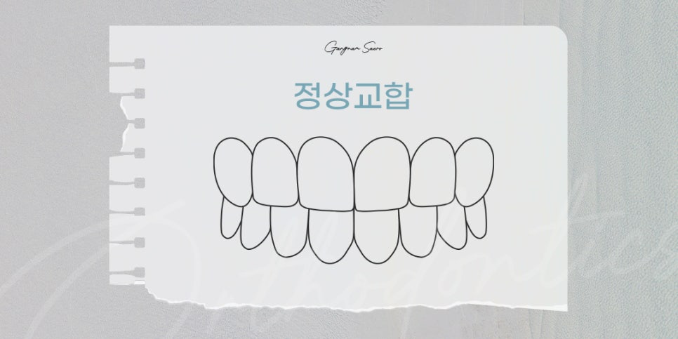 비수술 부정교합을 위한 치과 교정 (투명교정부정교합) 관련 이미지 3