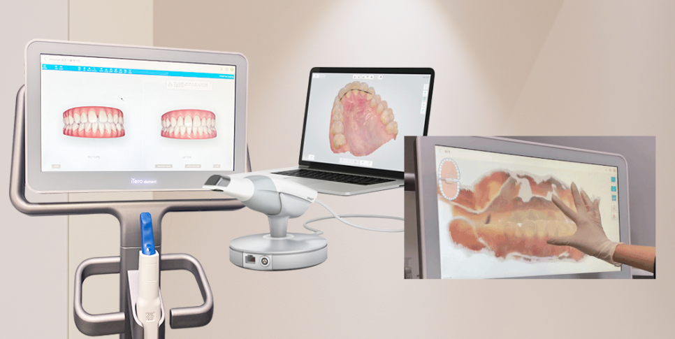 부작용 줄이는 임플란트 [ 네비게이션 임플란트 ] [ 강남새로치과 ] 관련 이미지 4