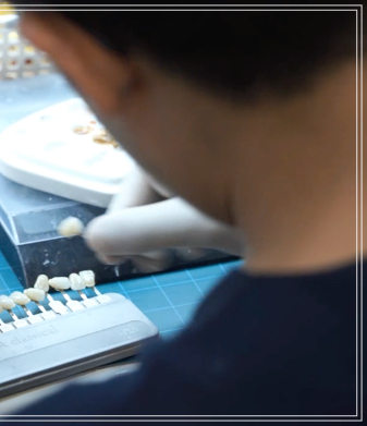 헨리라미네이트, 치아 손상없이 안전하게 진행 관련 이미지 9