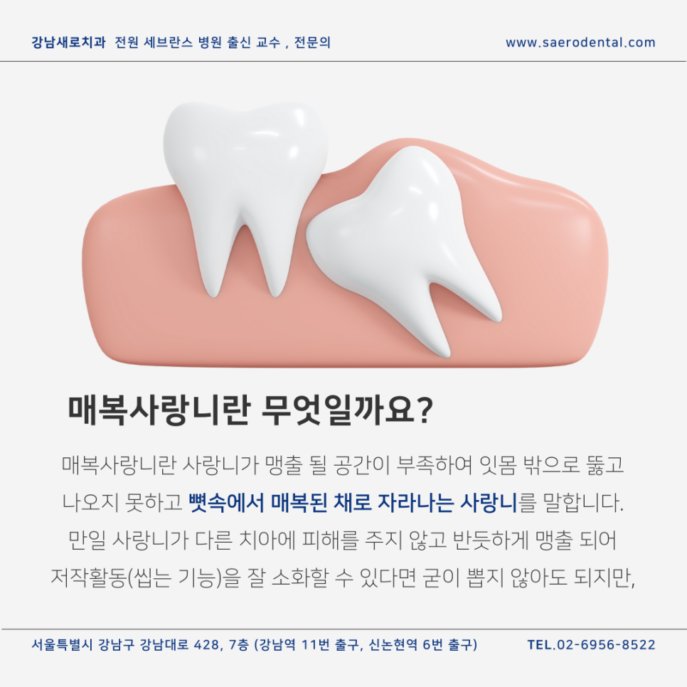 강남사랑니치과, 매복사랑니를 더욱 효율적으로 발치하려면 관련 이미지 3