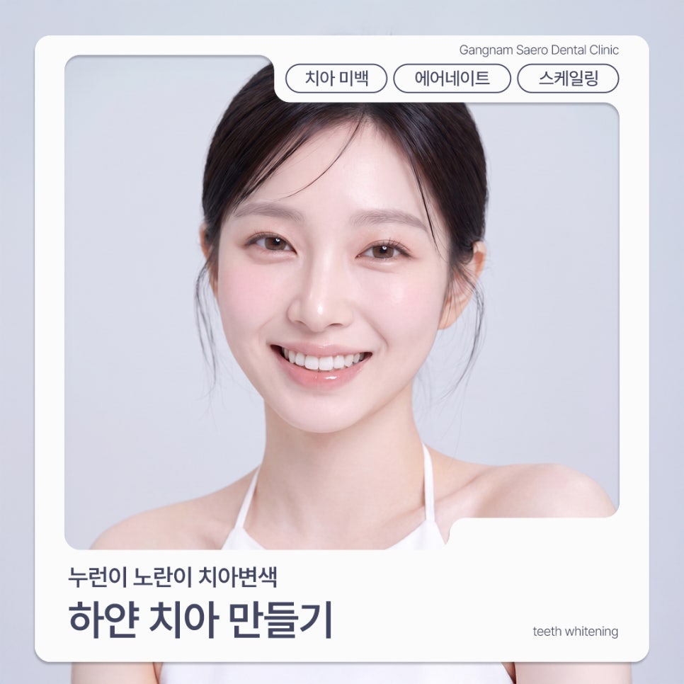 How to Get Whiter Teeth: Comparing Teeth Whitening, AirNate, and Scaling (Yellow Teeth and Tooth Discoloration) image 1