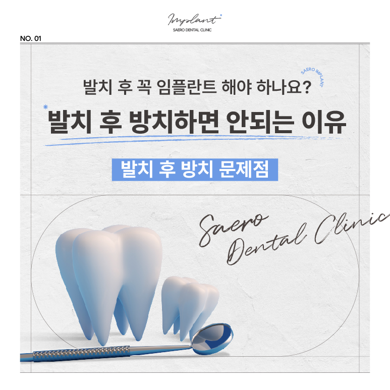 발치 후 임플란트 해야 하는 이유 (임플란트안하면) 관련 이미지 1