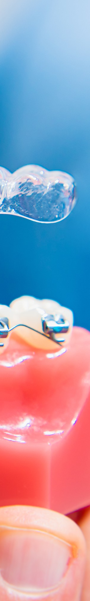 강남역치아교정, 비발치 치료, 구강 구조 개선, 맡길 수 있는 곳에! 관련 이미지 18