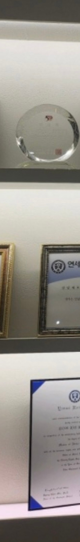 투명교정치료 일반적인 과정과 차이점은? 장점을 알아보자 관련 이미지 12