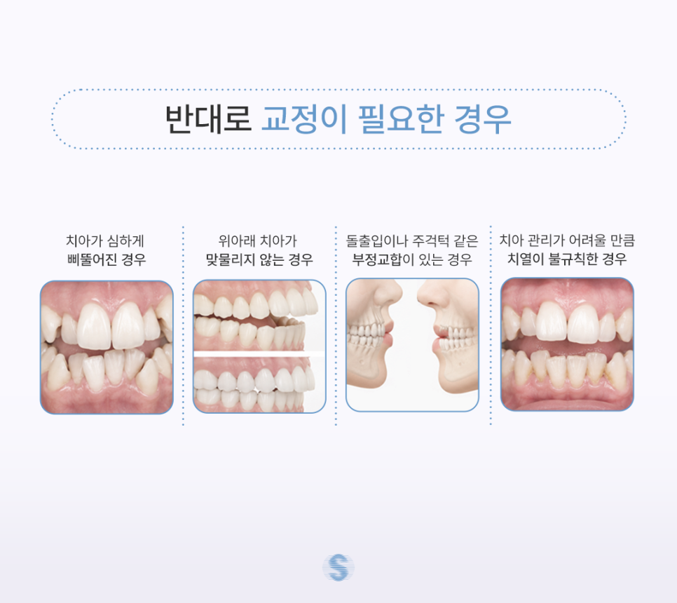 치아교정하지마라, 잘못 알려진 교정 정보 바로 잡아 드립니다 관련 이미지 6