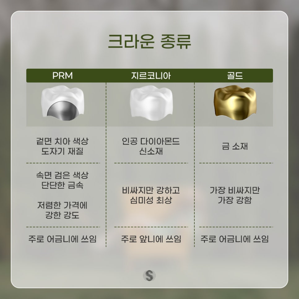 충치치료 신경치료 후 씌우기 (크라운이란?) 관련 이미지 3