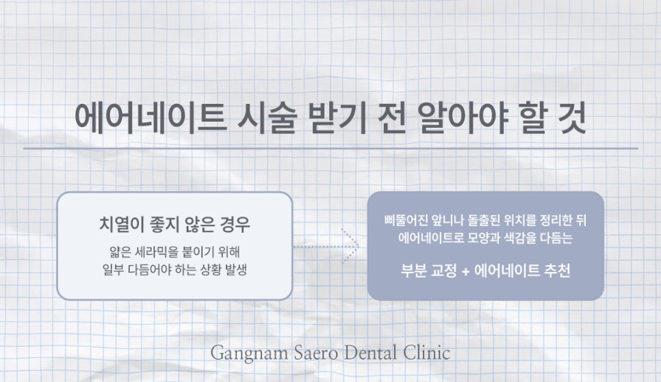 치아 컴플렉스 해결에는 삭제제로라미네이트 에어네이트 (무삭제라미네이트) 관련 이미지 7