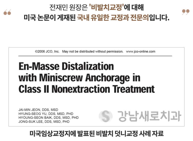 송곳니덧니교정, 방치하면 부작용이 발생한다? 관련 이미지 13