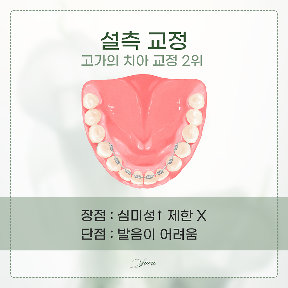 치아교정 가격이 어떻게 되나요? (치아교정비용) 관련 이미지 7