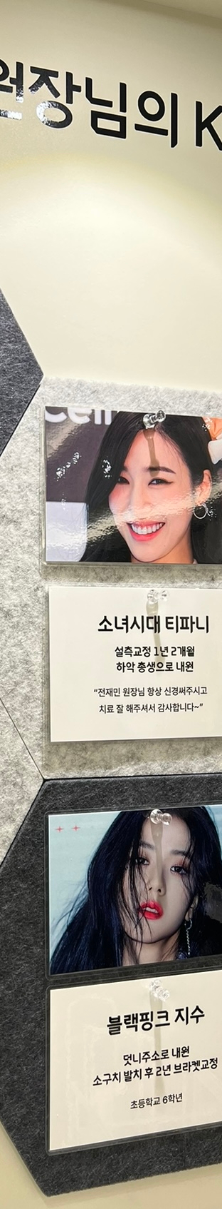 뻐드렁니교정치료, 돌출입을 단기간에 개선하는 방법? 관련 이미지 13