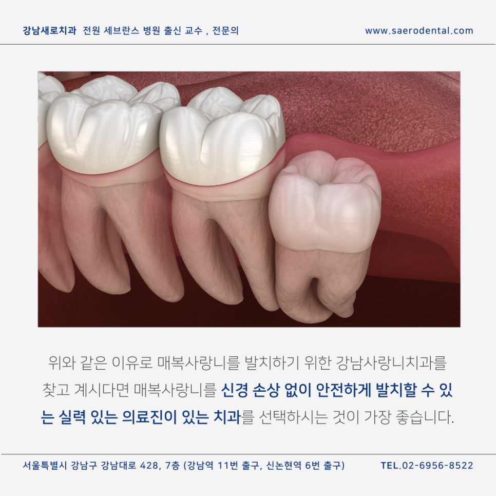 강남사랑니치과, 매복사랑니를 더욱 효율적으로 발치하려면 관련 이미지 5