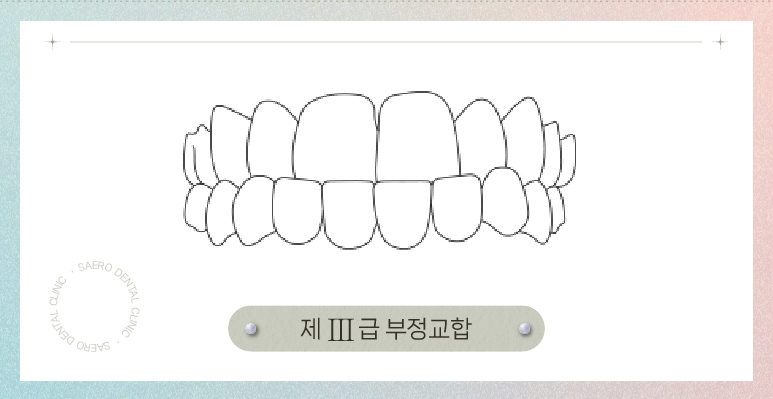 부정교합 투명교정으로 교정이 되나요? (부정교합교정) 관련 이미지 6