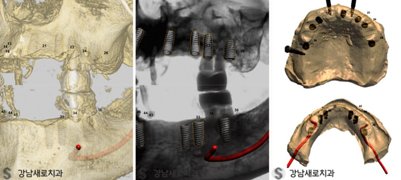 강남양심치과에서 문제 없이 진료를 진행하려면 관련 이미지 8