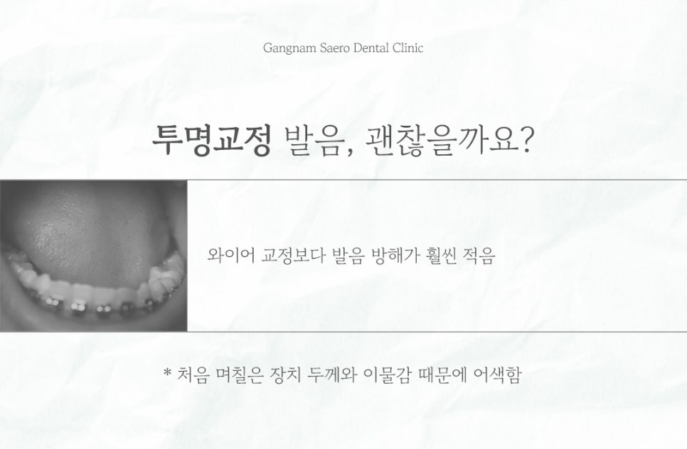 Clear Aligner Cost, Clear Aligner Pain, Clear Aligner Speech, and Eating with Clear Aligners (Q&A Collection) image 7
