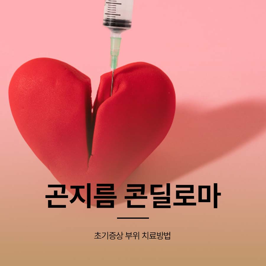 곤지름 콘딜로마 초기증상 부위 치료방법 관련 이미지 1