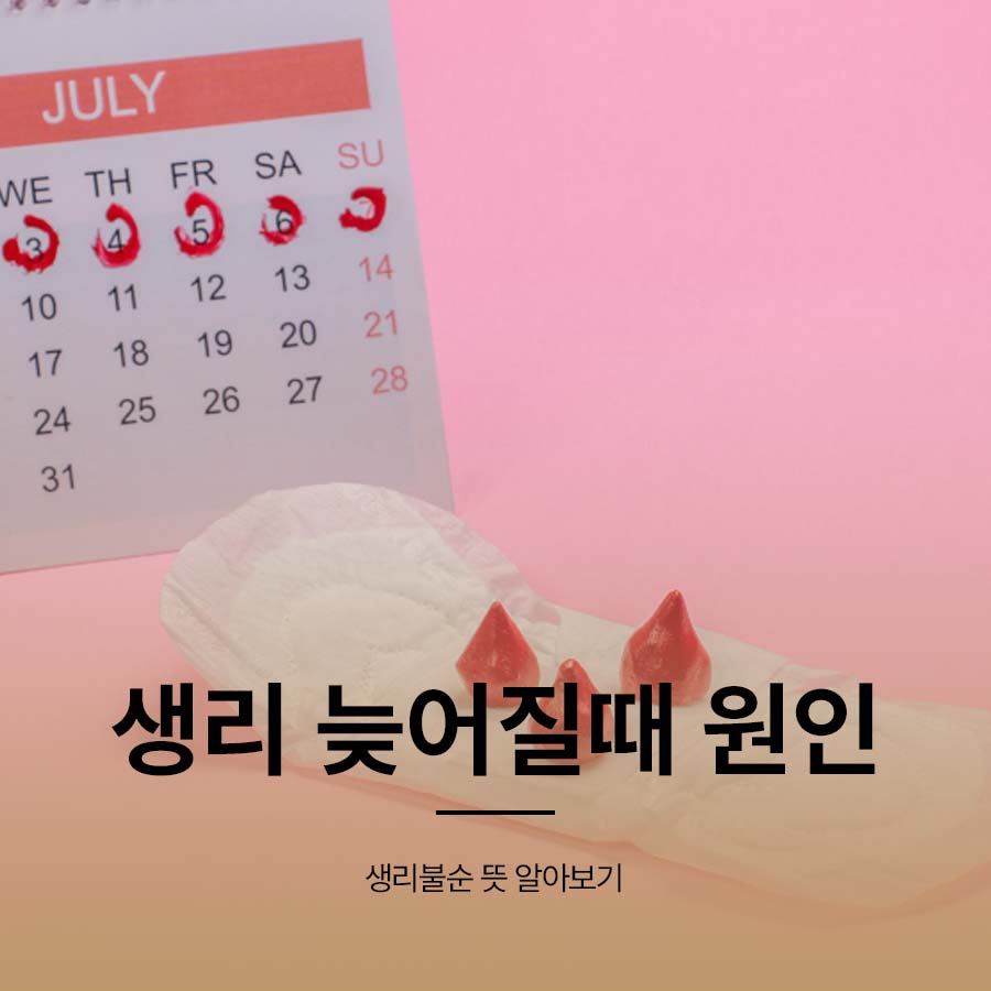 Causes of a Late Period: Understanding What Menstrual Irregularity Means image 1