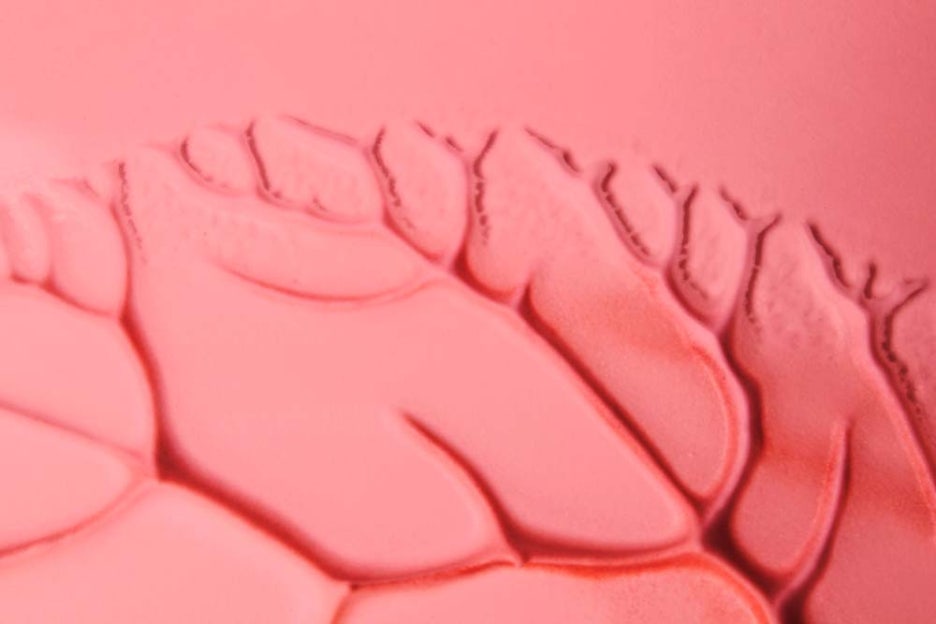Is a Cure Possible for Hidradenitis Suppurativa Symptoms and Affected Areas? image 2