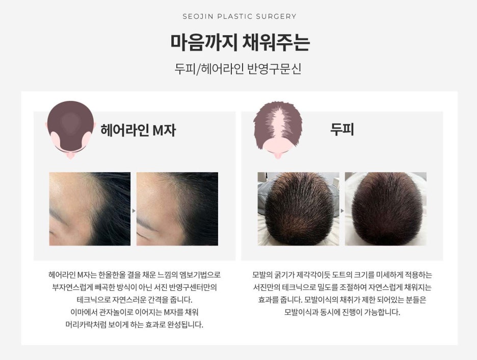 압구정신사 헤어라인반영구문신 깔끔한 이미지로 관련 이미지 2
