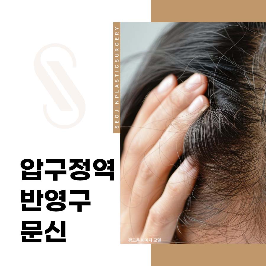 Apgujeong Station Semi-Permanent Makeup for Filling in the Scalp Hairline image 1