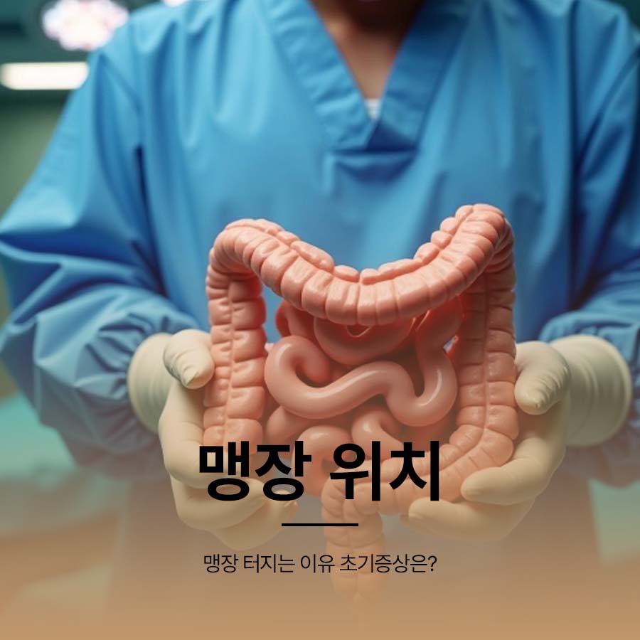 맹장 위치 및 터지는 이유 초기증상은? 관련 이미지 1