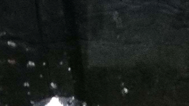 강남 가슴수술 부작용 분석 보형물제거 필요한 경우 관련 이미지 35
