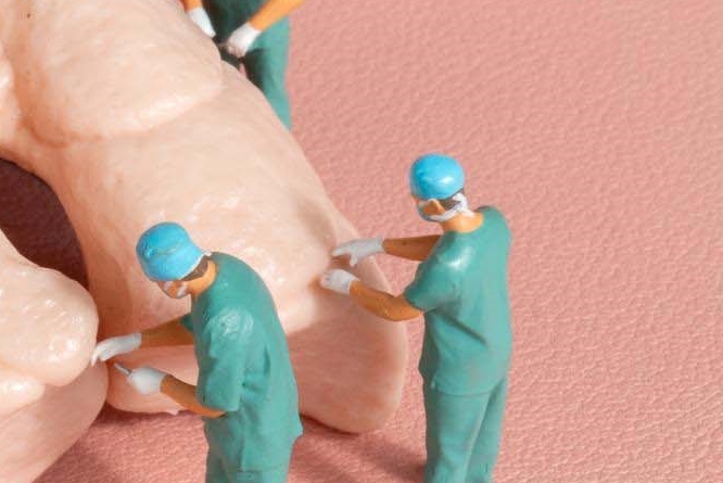 헤어라인모발이식 잘하는곳 내게 딱 맞는 비율로 관련 이미지 21