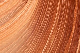 Hair Transplant Methods: A Summary of the Differences Between Incisional and Non-Incisional Procedures image 13