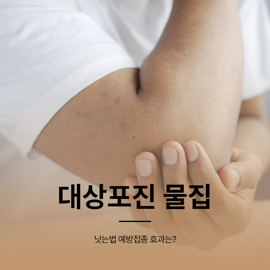 대상포진 물집 낫는법 예방접종 효과는? 관련 이미지 1