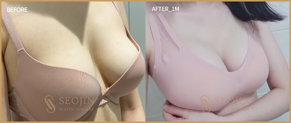 서진성형외과 성형수술 철저한 시스템으로 관련 이미지 3