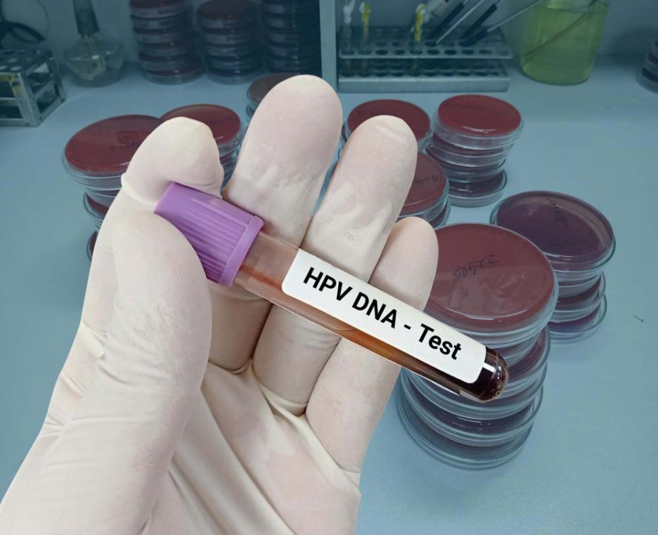 hpv 바이러스 고위험군 번호 치료방법 정리 관련 이미지 2