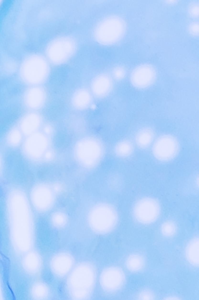 프랭크 징후, 귀 주름이 뇌혈관 위험 신호일까? 관련 이미지 13