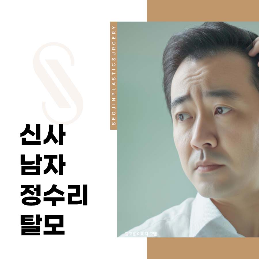 신사 남자정수리탈모 셀프진단법 및 예방법은? 관련 이미지 1