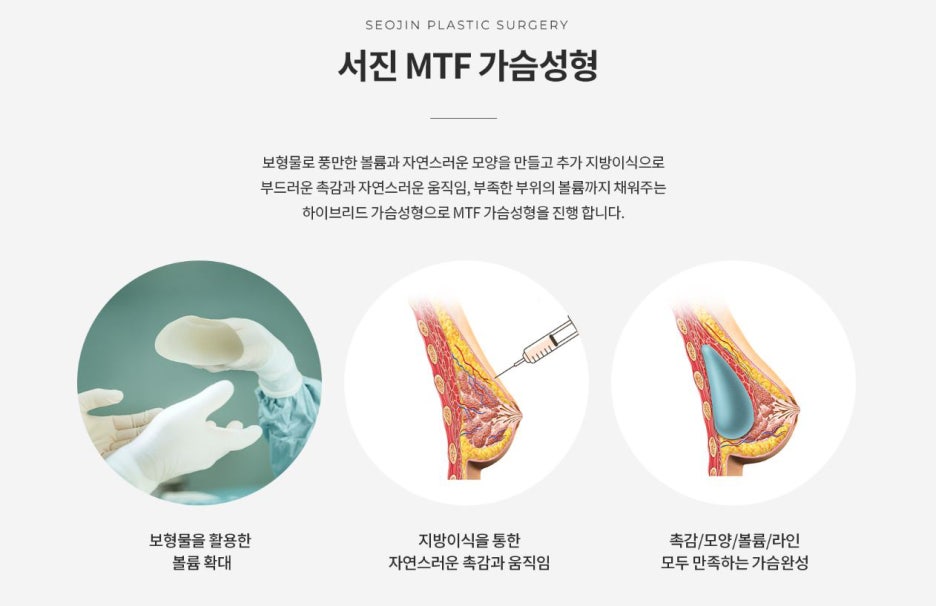 트랜스젠더(MTF) 가슴성형, 전문의와의 상담 필요해 관련 이미지 4