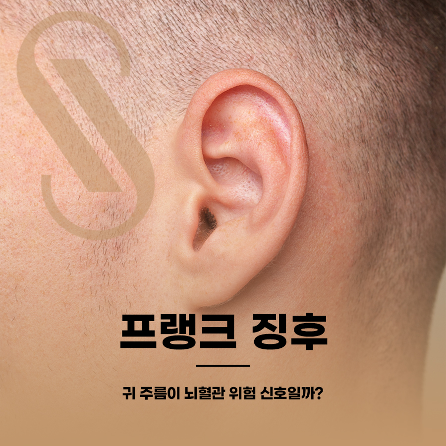 프랭크 징후, 귀 주름이 뇌혈관 위험 신호일까? 관련 이미지 1