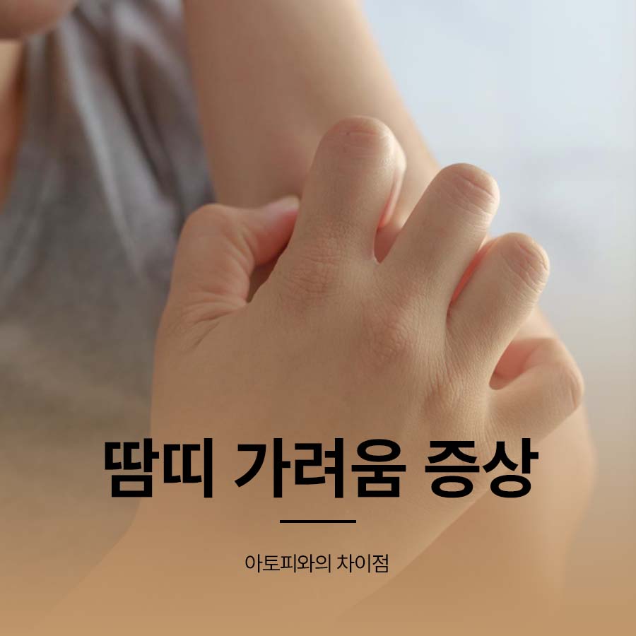 땀띠 가려움 증상 원인 아토피 차이점 관련 이미지 1