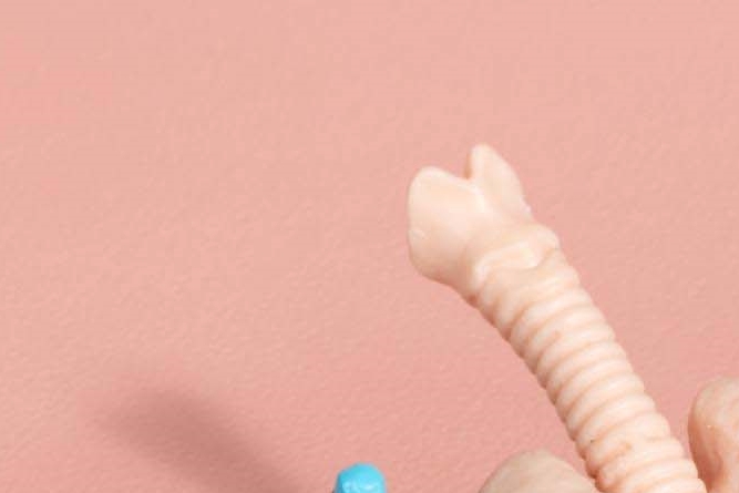 헤어라인모발이식 잘하는곳 내게 딱 맞는 비율로 관련 이미지 17