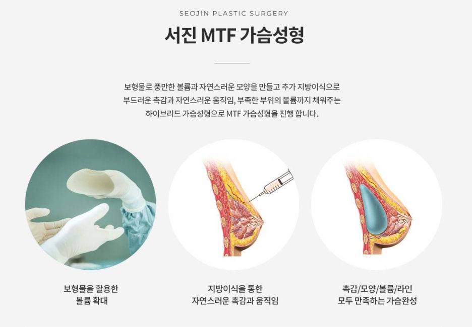 트랜스젠더 가슴성형(MTF 가슴수술) 난이도가 높으니까 관련 이미지 4