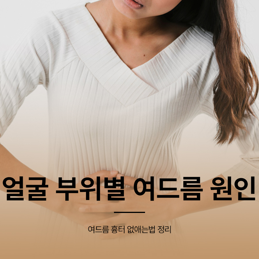 얼굴 부위별 여드름 원인 흉터 없애는법 정리 관련 이미지 1